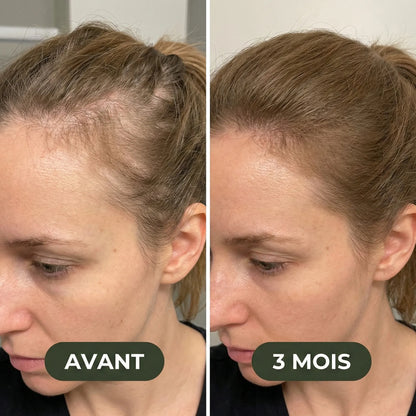 Sérum de croissance pour cheveux