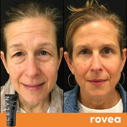 Crème Anti Rides et Cernes Instantanée