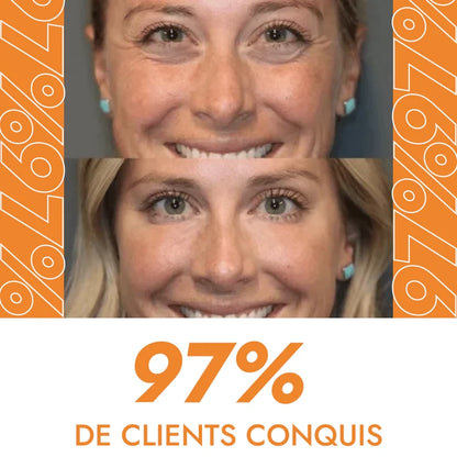 Crème Anti Rides et Cernes Instantanée